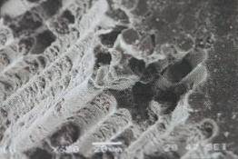 手把手教你纤维桩修复的精细化操作