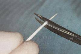 手把手教你纤维桩修复的精细化操作