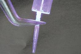 手把手教你纤维桩修复的精细化操作