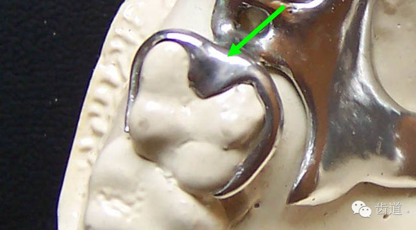 卡环的结构和各部分的作用【山东建筑材料网络社区】