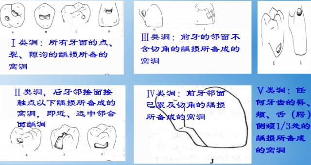 牙体牙髓常见病