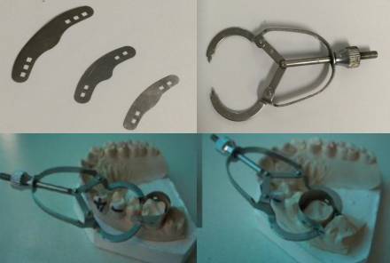 什么叫口腔器械【牙医干货】快来收藏吧！！！口腔内科常用器械大全_https://www.jmylbn.com_新闻资讯_第4张