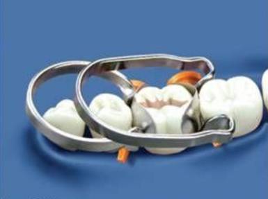 牙胶尖什么颜色口腔内科常用器械解析_https://www.jmylbn.com_新闻资讯_第6张