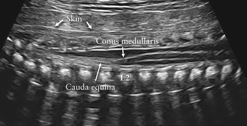 胎儿mt是什么检查什么疼吗ISUOG胎儿中枢神经系统超声检查指南（2020）第一部分：筛查及针对性神经超声检查的适应症_https://www.jmylbn.com_新闻资讯_第4张