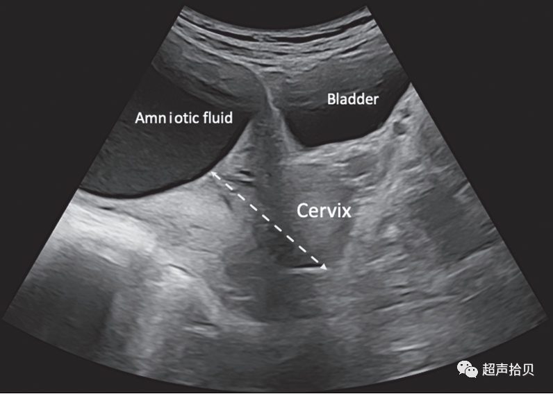 胎儿mt是什么检查什么疼吗【文献学习】【规范、指南】ISUOG实践指南：中孕期胎儿常规超声检查（2022更新）_https://www.jmylbn.com_新闻资讯_第24张
