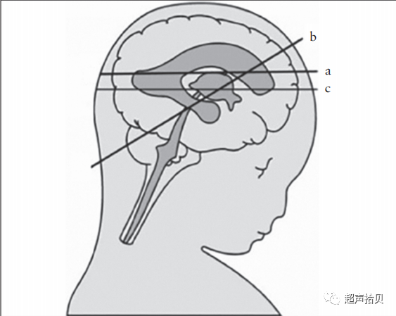 胎儿mt是什么检查什么疼吗【文献学习】【规范、指南】ISUOG实践指南：中孕期胎儿常规超声检查（2022更新）_https://www.jmylbn.com_新闻资讯_第6张