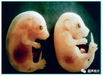 胎儿mt是什么检查什么疼吗【早孕专题】11-13周胎儿超声检查：胎儿染色体异常筛查 IV -NT增厚的管理_https://www.jmylbn.com_新闻资讯_第3张