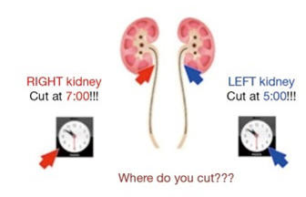 输尿管鞘是什么输尿管软镜碎石术_https://www.jmylbn.com_新闻资讯_第19张
