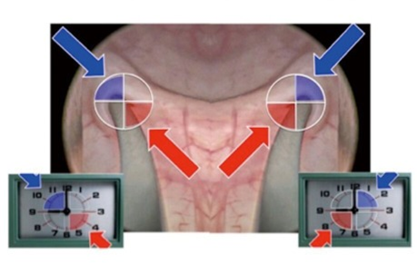 输尿管鞘是什么输尿管软镜碎石术_https://www.jmylbn.com_新闻资讯_第8张