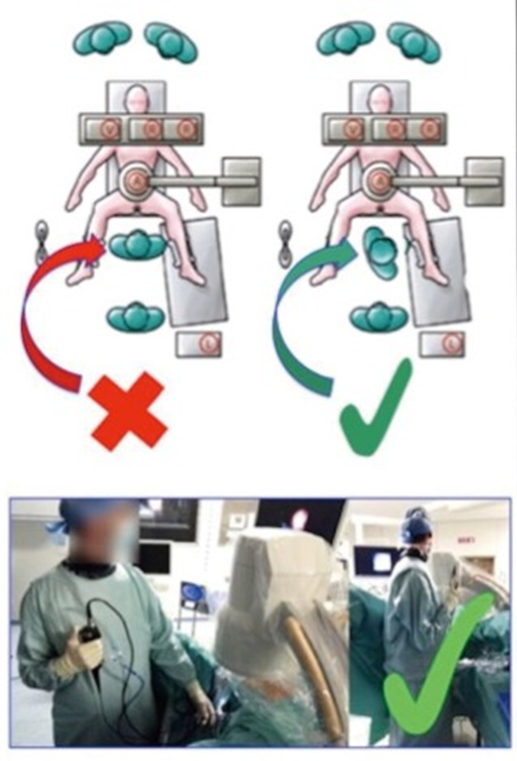 输尿管鞘是什么输尿管软镜碎石术_https://www.jmylbn.com_新闻资讯_第5张
