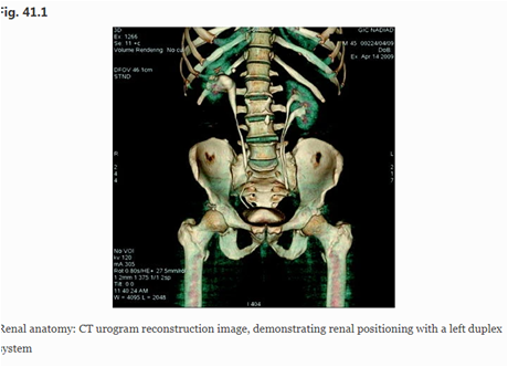 取石球囊怎么取石经皮肾镜取石术的要点_https://www.jmylbn.com_新闻资讯_第1张