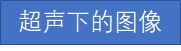 体外碎石b超怎么定位输尿管下段结石（壁间段结石）体外冲击波碎石要点_https://www.jmylbn.com_新闻资讯_第6张