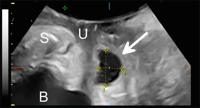 怎么看尿流量尿动力学检查_https://www.jmylbn.com_新闻资讯_第11张