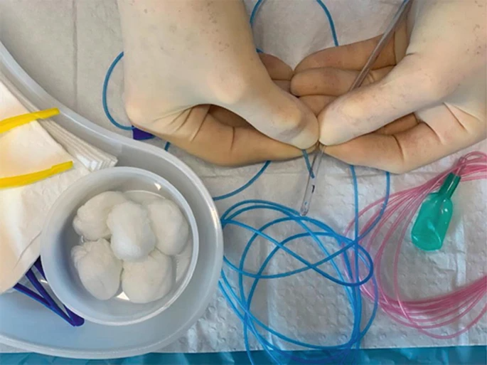 怎么看尿流量尿动力学检查_https://www.jmylbn.com_新闻资讯_第2张