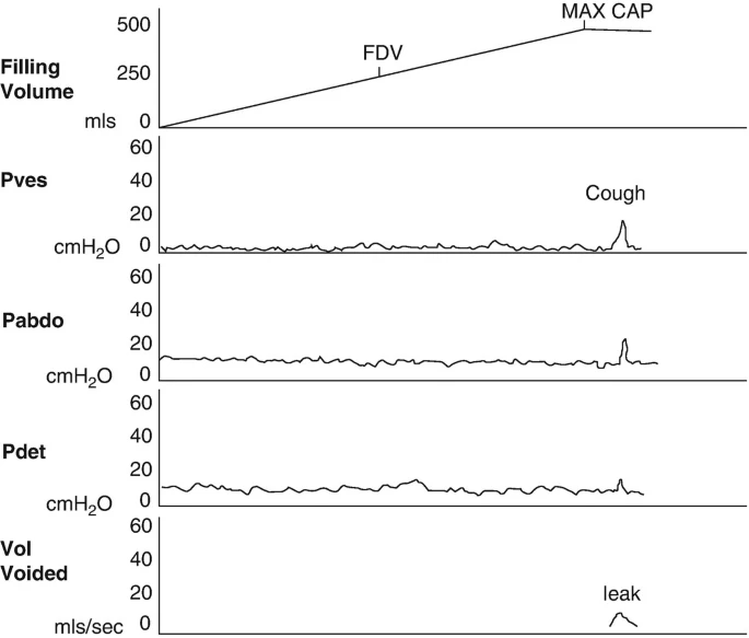 怎么看尿流量尿动力学检查_https://www.jmylbn.com_新闻资讯_第3张