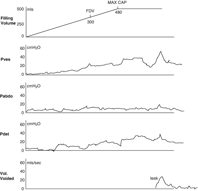 怎么看尿流量尿动力学检查_https://www.jmylbn.com_新闻资讯_第9张