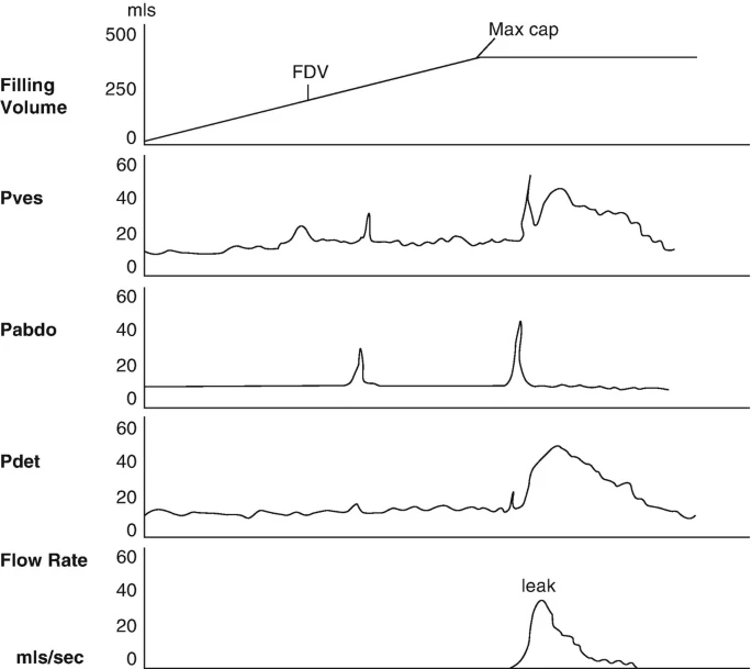 怎么看尿流量尿动力学检查_https://www.jmylbn.com_新闻资讯_第6张