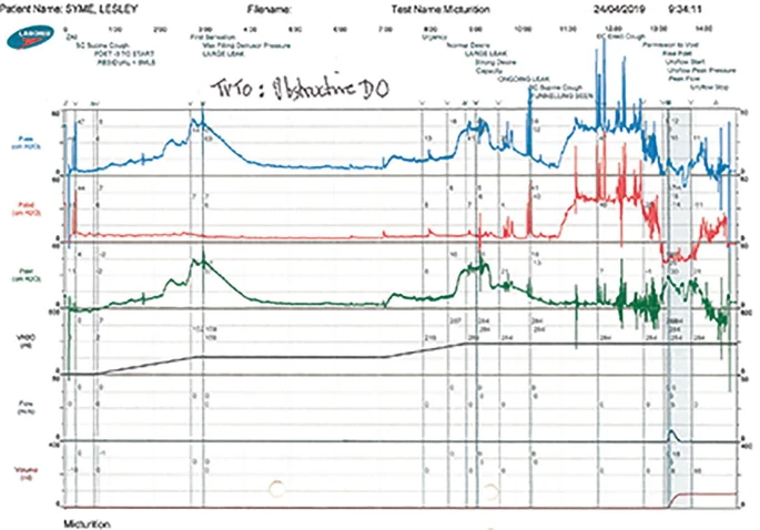 怎么看尿流量尿动力学检查_https://www.jmylbn.com_新闻资讯_第8张