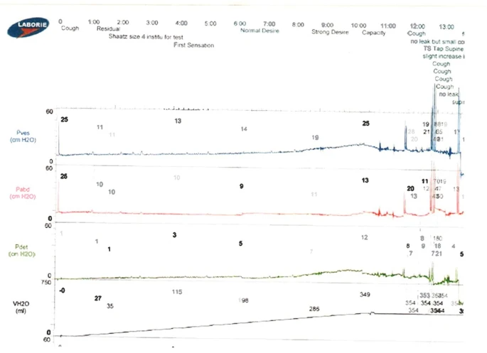 怎么看尿流量尿动力学检查_https://www.jmylbn.com_新闻资讯_第5张