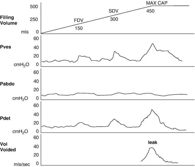 怎么看尿流量尿动力学检查_https://www.jmylbn.com_新闻资讯_第4张