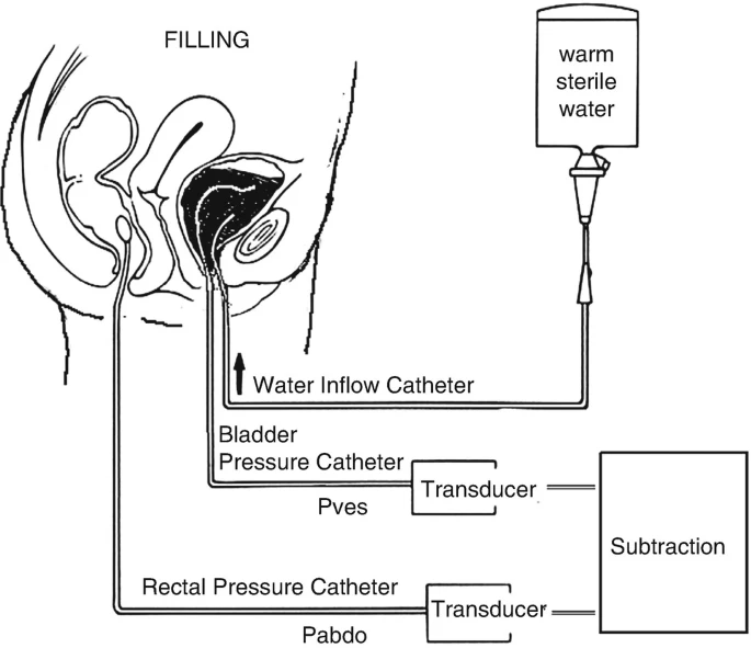 怎么看尿流量尿动力学检查_https://www.jmylbn.com_新闻资讯_第1张