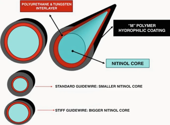 活检钳怎么消毒输尿管软镜手术器械：导丝、输尿管通路鞘、取石篮及活检器械、内镜消毒与维护_https://www.jmylbn.com_新闻资讯_第2张