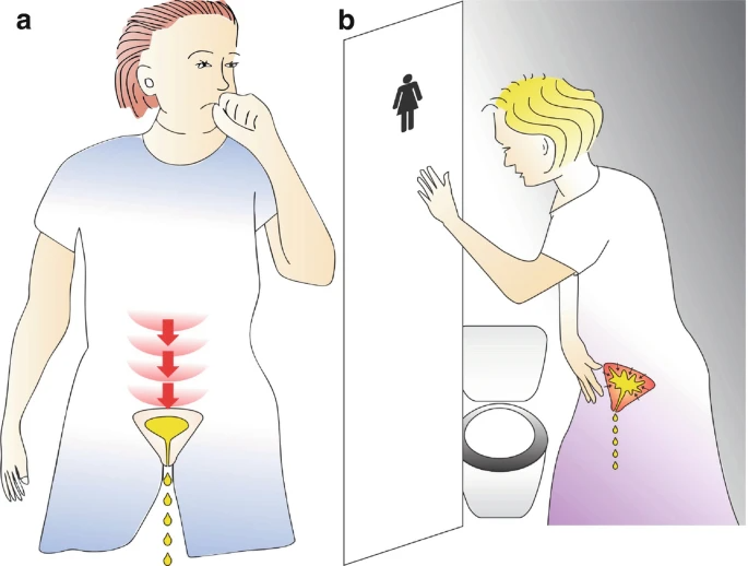 女性尿失禁或脱垂病史_医学界-助力医生临床决策和职业成长