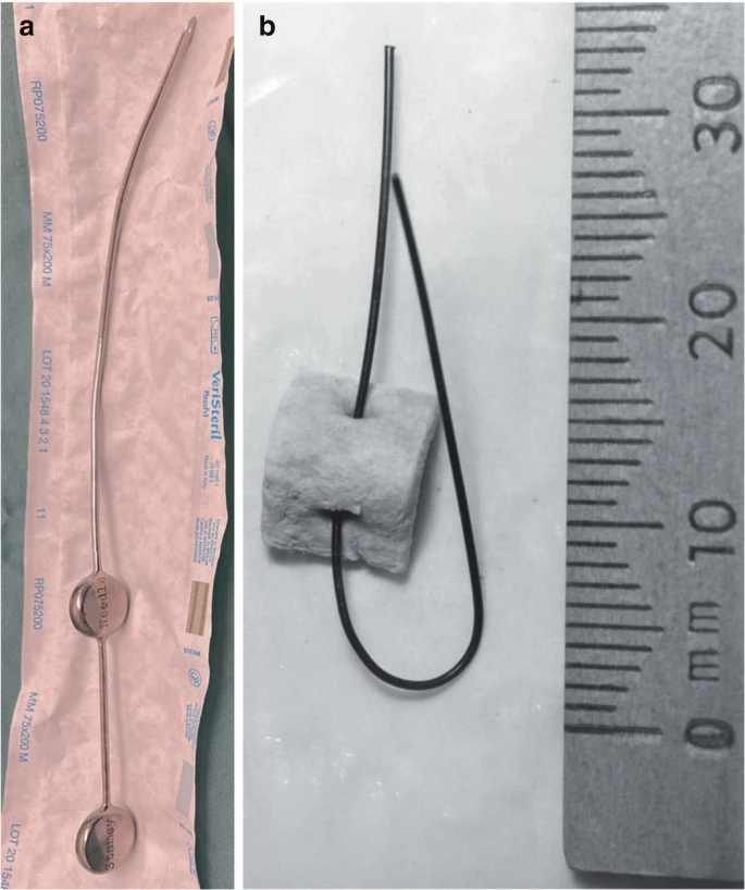 压力性尿失禁标准手术_医学界-助力医生临床决策和职业成长
