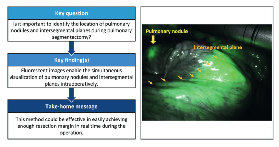 什么是数字肺膨胀肺／萎陷肺的真相：人工气胸下的支气管+肺实质数字模型与三维重建？_https://www.jmylbn.com_新闻资讯_第14张