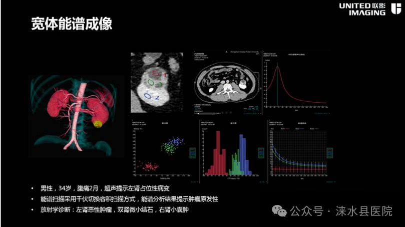 医院仪器怎么成像【涞水县医疗卫生集团·涞水县医院】精准医学 影像先行丨我院引进联影uCT860高端CT天河320仪器_https://www.jmylbn.com_新闻资讯_第10张