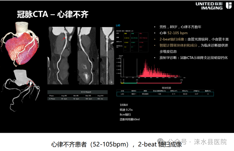 医院仪器怎么成像【涞水县医疗卫生集团·涞水县医院】精准医学 影像先行丨我院引进联影uCT860高端CT天河320仪器_https://www.jmylbn.com_新闻资讯_第7张