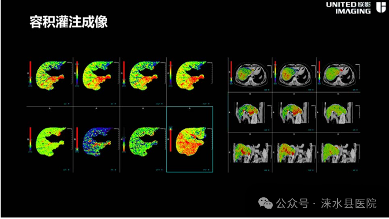 医院仪器怎么成像【涞水县医疗卫生集团·涞水县医院】精准医学 影像先行丨我院引进联影uCT860高端CT天河320仪器_https://www.jmylbn.com_新闻资讯_第11张