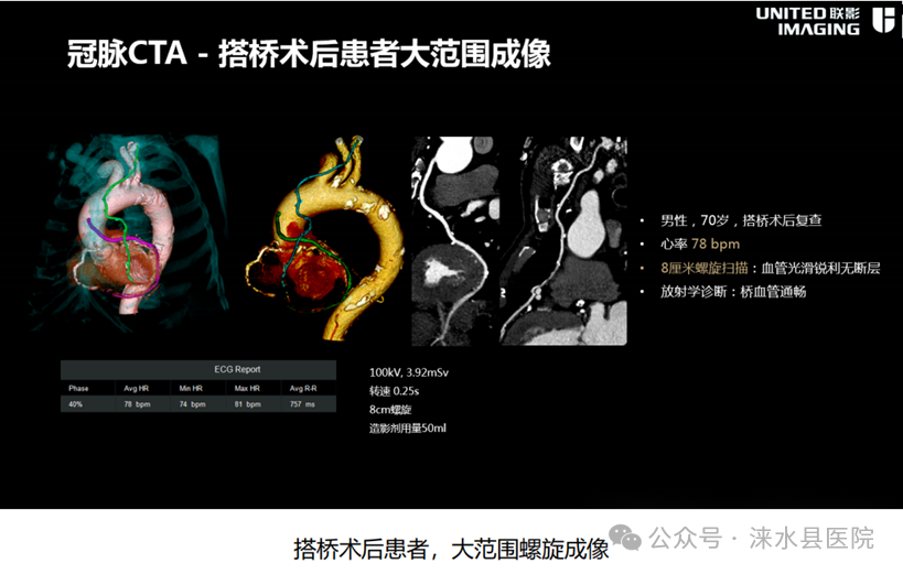 医院仪器怎么成像【涞水县医疗卫生集团·涞水县医院】精准医学 影像先行丨我院引进联影uCT860高端CT天河320仪器_https://www.jmylbn.com_新闻资讯_第8张