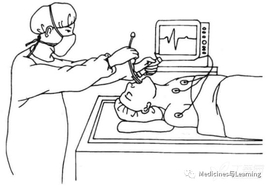 气管插管牙垫怎么放气管插管术具体流程_https://www.jmylbn.com_新闻资讯_第10张