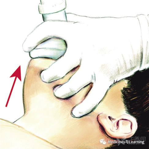 气管插管牙垫怎么放气管插管术具体流程_https://www.jmylbn.com_新闻资讯_第11张
