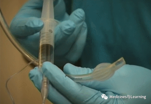 气管插管牙垫怎么放气管插管术具体流程_https://www.jmylbn.com_新闻资讯_第6张