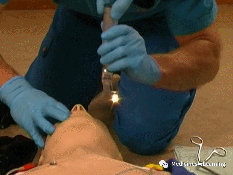 气管插管牙垫怎么放气管插管术具体流程_https://www.jmylbn.com_新闻资讯_第14张