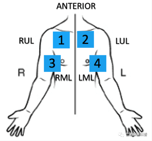 床旁x怎么使用床旁肺部超声检查_https://www.jmylbn.com_新闻资讯_第6张