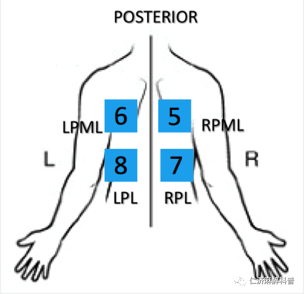 床旁x怎么使用床旁肺部超声检查_https://www.jmylbn.com_新闻资讯_第7张