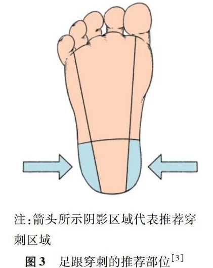 儿童末梢采血针有哪些一文带你读懂儿童末梢采血_https://www.jmylbn.com_新闻资讯_第15张