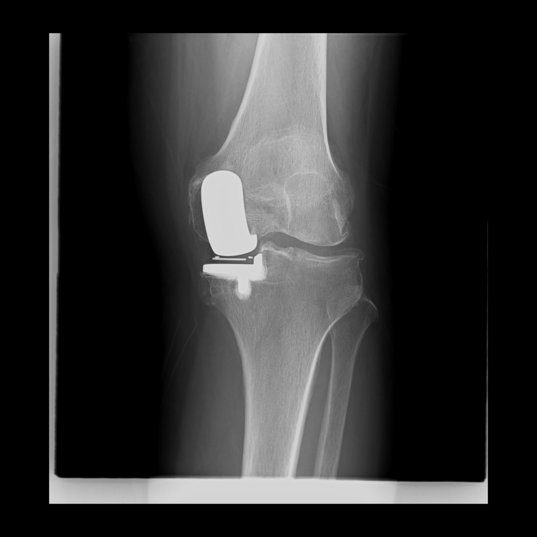 岛津有哪些影像设备【技术推荐】我院医学影像中心引进全新高端多功能设备——岛津C200平板数字多功能X线机_https://www.jmylbn.com_新闻资讯_第6张