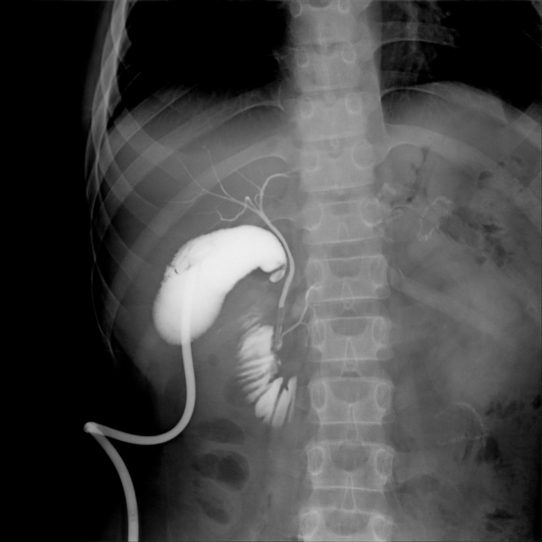岛津有哪些影像设备【技术推荐】我院医学影像中心引进全新高端多功能设备——岛津C200平板数字多功能X线机_https://www.jmylbn.com_新闻资讯_第7张