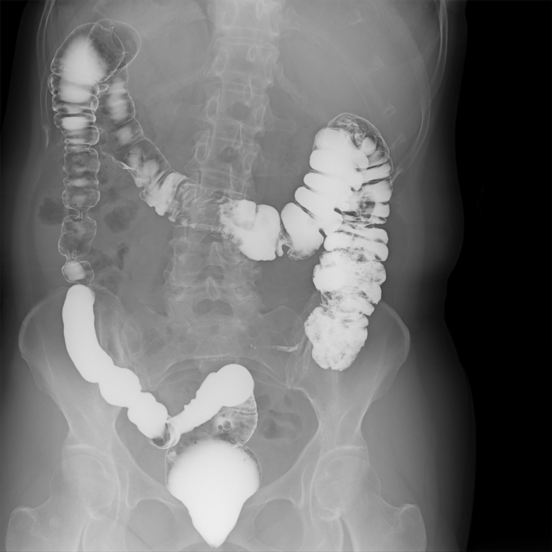 岛津有哪些影像设备【技术推荐】我院医学影像中心引进全新高端多功能设备——岛津C200平板数字多功能X线机_https://www.jmylbn.com_新闻资讯_第8张