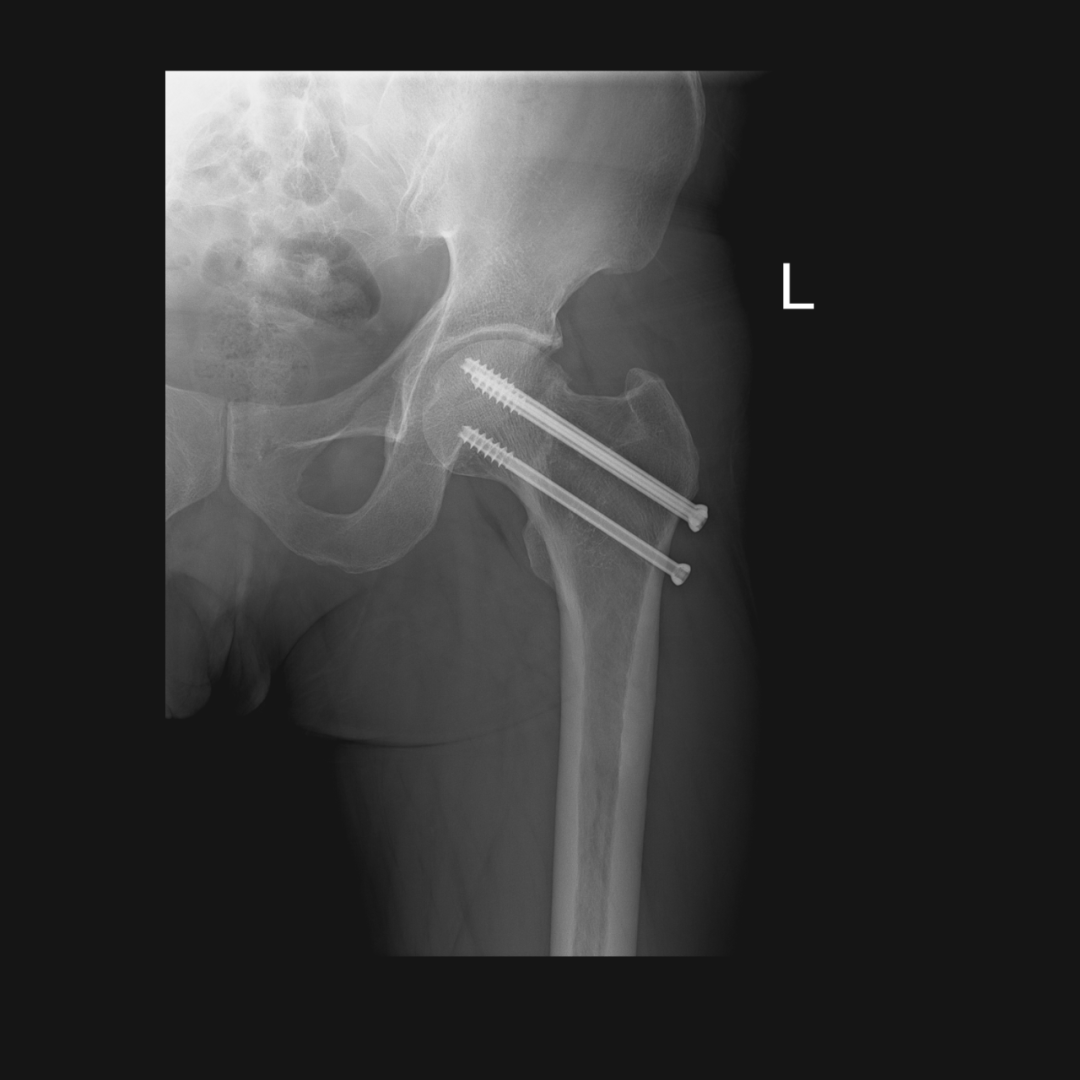 岛津有哪些影像设备【技术推荐】我院医学影像中心引进全新高端多功能设备——岛津C200平板数字多功能X线机_https://www.jmylbn.com_新闻资讯_第5张