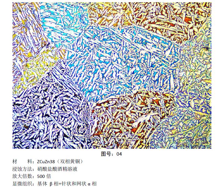 马氏体、奥氏体、珠光体，20种材料彩色金相！的图5