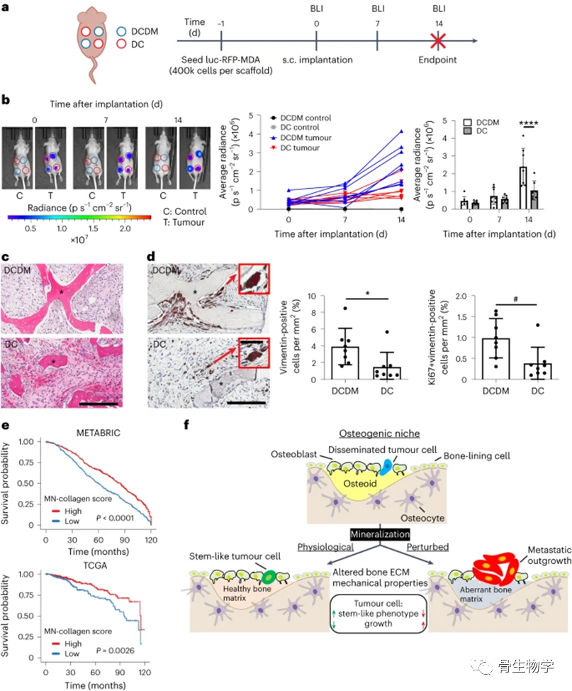 医用诱导骨基质是什么骨生物学进展：骨基质矿化抑制整合素介导的乳腺癌机械信号传导和转移进展_https://www.jmylbn.com_新闻资讯_第7张
