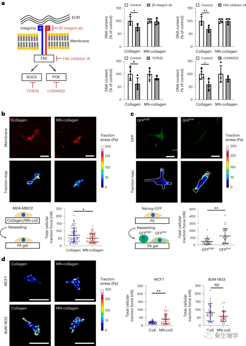 医用诱导骨基质是什么骨生物学进展：骨基质矿化抑制整合素介导的乳腺癌机械信号传导和转移进展_https://www.jmylbn.com_新闻资讯_第5张