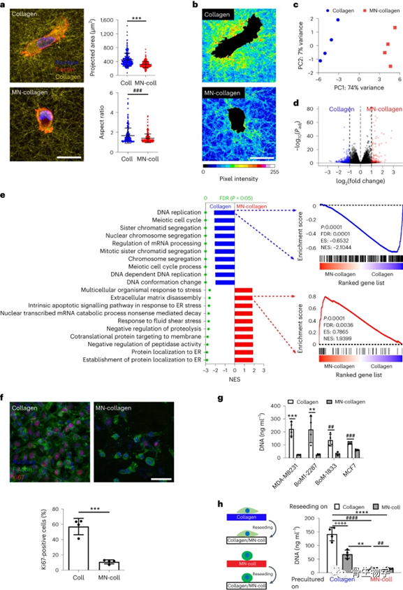 医用诱导骨基质是什么骨生物学进展：骨基质矿化抑制整合素介导的乳腺癌机械信号传导和转移进展_https://www.jmylbn.com_新闻资讯_第3张