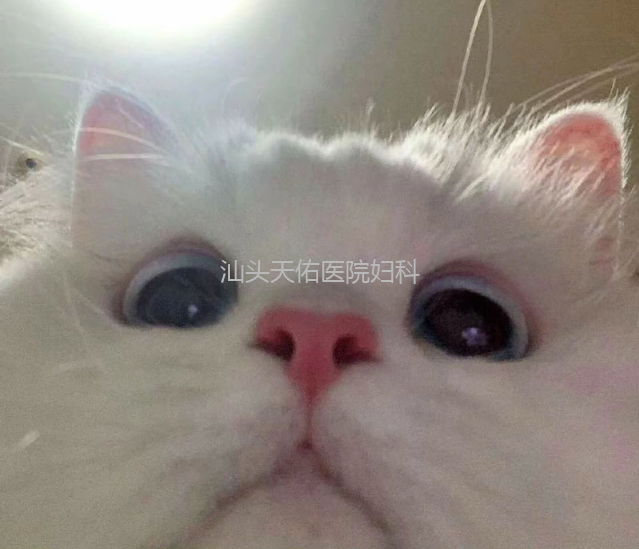 汕头彩超怎么样四维小科普 4 问 4 答，你不清楚的都在这篇推文里！『汕头市妇产医院』_https://www.jmylbn.com_新闻资讯_第2张