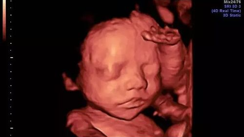 汕头彩超怎么样四维彩超啥时候预约？它检查什么？看了这篇全明白！『汕头妇产科医院』_https://www.jmylbn.com_新闻资讯_第6张